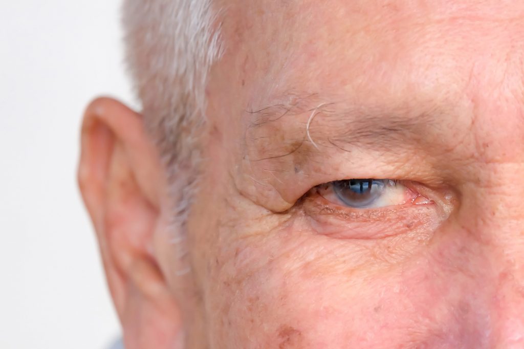 10 factores que incrementan el riesgo de padecer Glaucoma